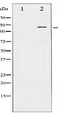 Phospho-FAK (Tyr576) Antibody