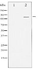 PKD1/2/3/PKC μ Antibody