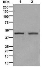 Glutamine Synthetase Antibody