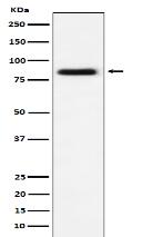 CD105 Antibody