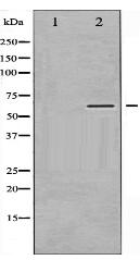 Phospho-CaMK2 alpha/ beta/ delta (Thr305) Antibody