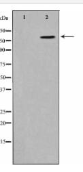 Phospho-CD227/MUC1(Tyr1229) Antibody