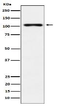 TPO Antibody