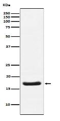 Cardiac Troponin C Antibody