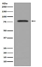 PKC beta 2 Antibody