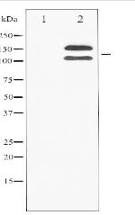 Phospho-FGFR1 (Tyr154) Antibody