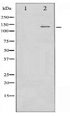Phospho-FGFR1 (Tyr654) Antibody