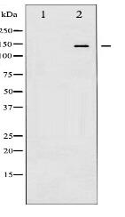 Phospho-Calcium Sensing Receptor (Thr888) Antibody