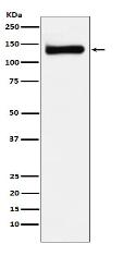 RENT1 / hUPF1 Antibody