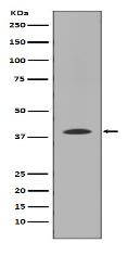 MMP12 Antibody