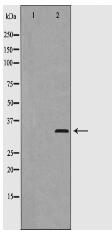 Phospho-Cyclin D2 (Thr280) Antibody