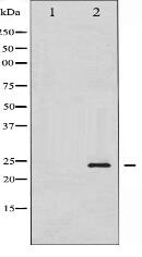 Phospho-Caveolin-1 (Tyr14) Antibody