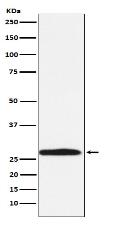 Carbonic Anhydrase 1 Antibody