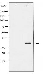 Phospho-BCL-2 (Ser70) Antibody