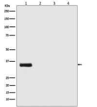Renilla Luciferase Antibody