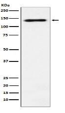 RNA Helicase A Antibody