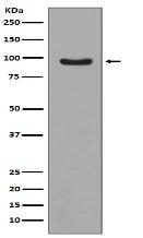 Phospho-FoxO3a (S253) Antibody