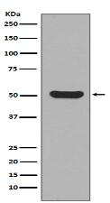 Cytokeratin 16 Antibody
