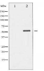 Phospho-Chk2 (Thr68) Antibody