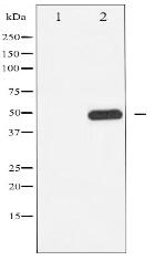 Phospho-CaMK2 (Thr286) Antibody