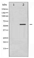Phospho-CaMK4 (Thr196/200) Antibody