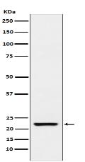 TAGLN Antibody