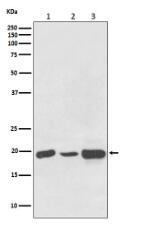 NDUFB8 Antibody