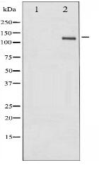 Phospho-FAK (Tyr861) Antibody
