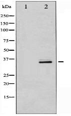 Phospho-CDK5 (Tyr15) Antibody