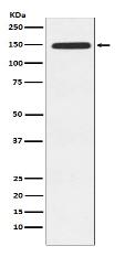 Xanthine Oxidase Antibody