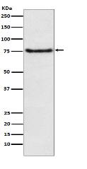 BDKRB2 Antibody