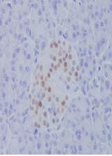 NKX2.2 Antibody