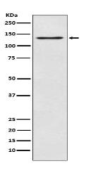 MGEA5 Antibody