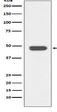 IKB beta Antibody