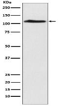 CHD1L Antibody