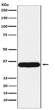 Tropomyosin 1 Antibody