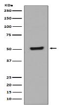 Phospho-p53 (T55) Antibody