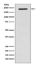 Tuberin Antibody