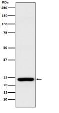 Rab25 Antibody