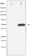 Phospho-BLNK (Tyr96) Antibody