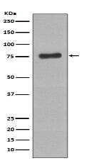 Phospho-BTK (Y223) Antibody