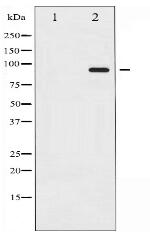 Phospho-Catenin- beta (Thr41/Ser45) Antibody
