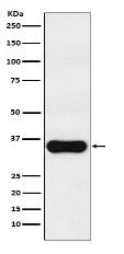 MC1 Receptor Antibody