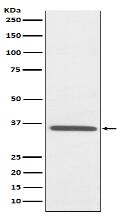 Fibrillarin Antibody