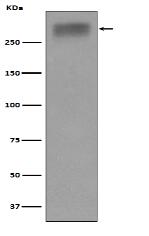 Thyroglobulin Antibody