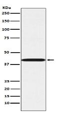 P2Y6 Antibody