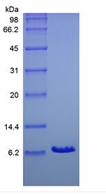 Recombinant Human Insulin-like Growth Factor-1