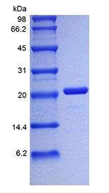 Recombinant Human Interleukin-6