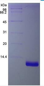 Recombinant Human Macrophage Inflammatory Protein-3/CCL23