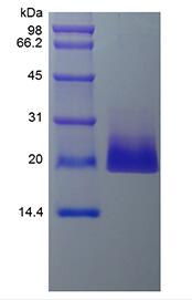 Recombinant Human 4-1BB Ligand/TNFSF9